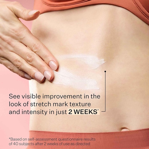 StriVectin SD Advanced Plus Intensive Moisturizer for Wrinkles and Stretch Marks - Picture 7 of 13